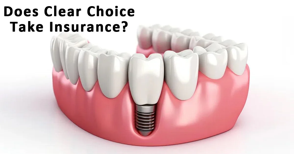 Does Clear Choice Take Insurance